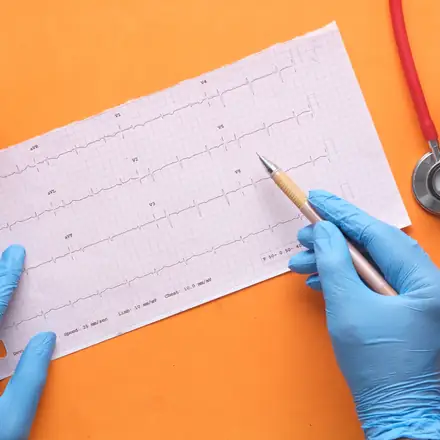 An ECG strip, a stethoscope and a heart model
