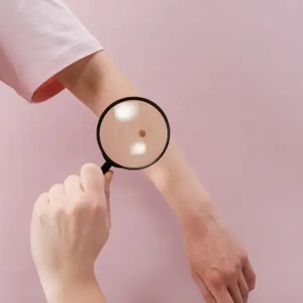 A dermatologist checking skin with a magnifier