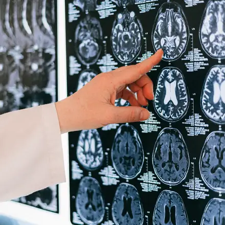 A finger pointing at brain MRI scans