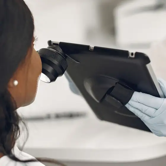 A dermatoscope connected to a tablet