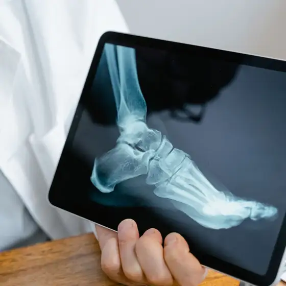 A foot X-ray on a tablet