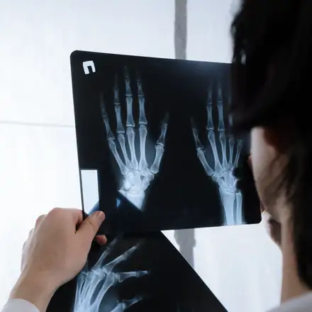 A doctor reviewing hand X-rays