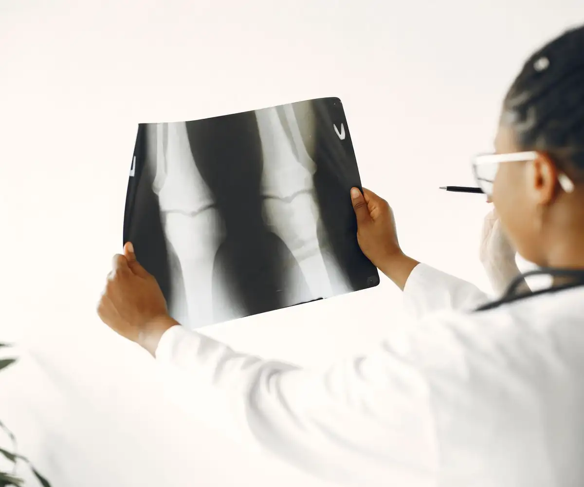 A doctor studying a knee X-ray